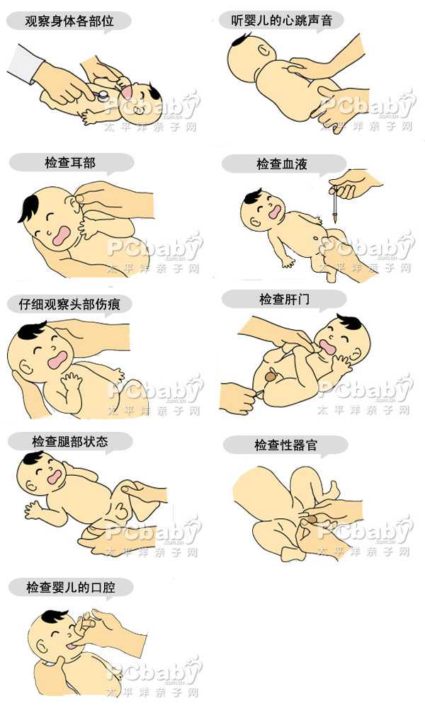 新生儿体检 新生儿体检