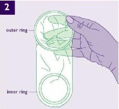 女用避孕套使用方法（演示） 帮你安全渡过&ldquo;造人计划&rdquo;