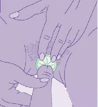 女用避孕套使用方法（演示） 帮你安全渡过&ldquo;造人计划&rdquo;