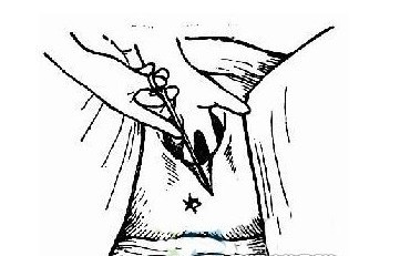 女人顺产侧切全过程(图片)