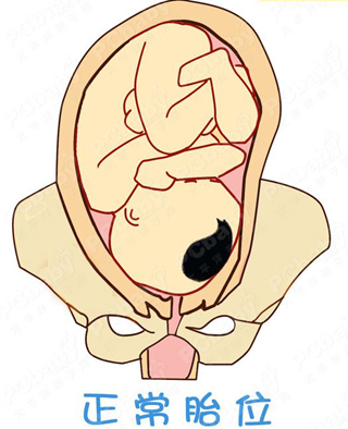 胎位不正怎么办?纠正胎位的正方法(图)