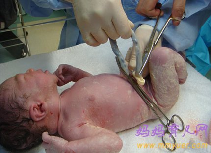 新生儿脐带 剪早剪晚2分钟的差别这么大!