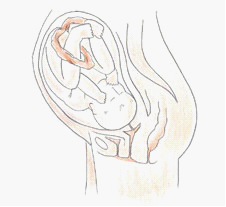 四维彩超&mdash;南京解放军454医院妇产科