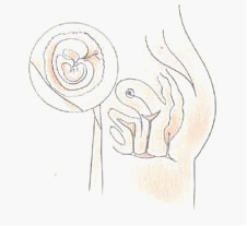 四维彩超&mdash;南京解放军454医院妇产科