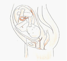 四维彩超&mdash;南京解放军454医院妇产科