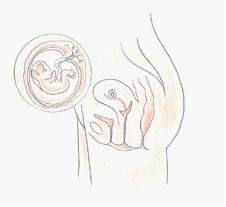 四维彩超&mdash;南京解放军454医院妇产科