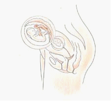 四维彩超&mdash;南京解放军454医院妇产科