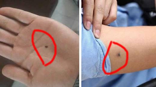 女人身上十大福痣:关于身上长痣的解读 女人身上十大福痣:关于身上长痣的解读