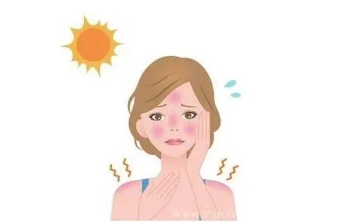 治湿疹最好的药膏有哪些?