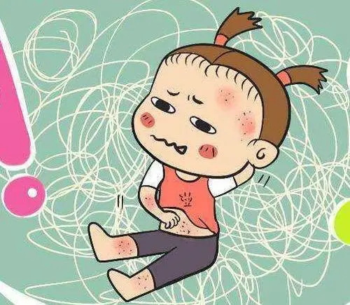 湿疹瘙痒如何解决?治疗湿疹最有效的三个方法