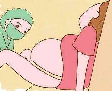 怎么做能让宫口开的快 怎么做可以顺产快一点