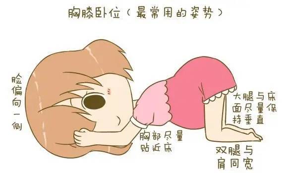 横位纠正胎位的9个方法