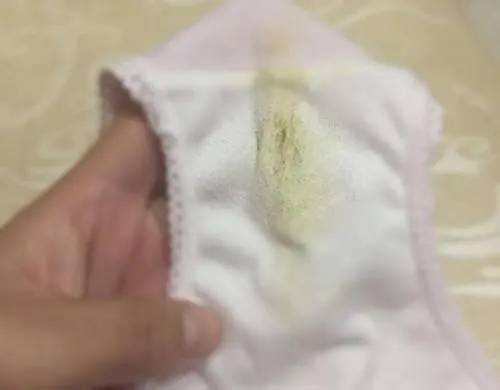 怎么从内裤上判断怀孕了 从内裤上判断怀孕准吗?