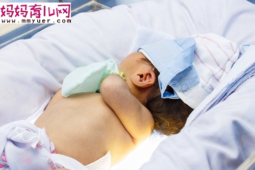 婴儿常见皮肤病有哪些 15种婴儿常见皮肤病